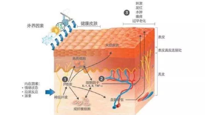 錦州市“屏障修復”修復的是什么？不同膚質該如何搭配？